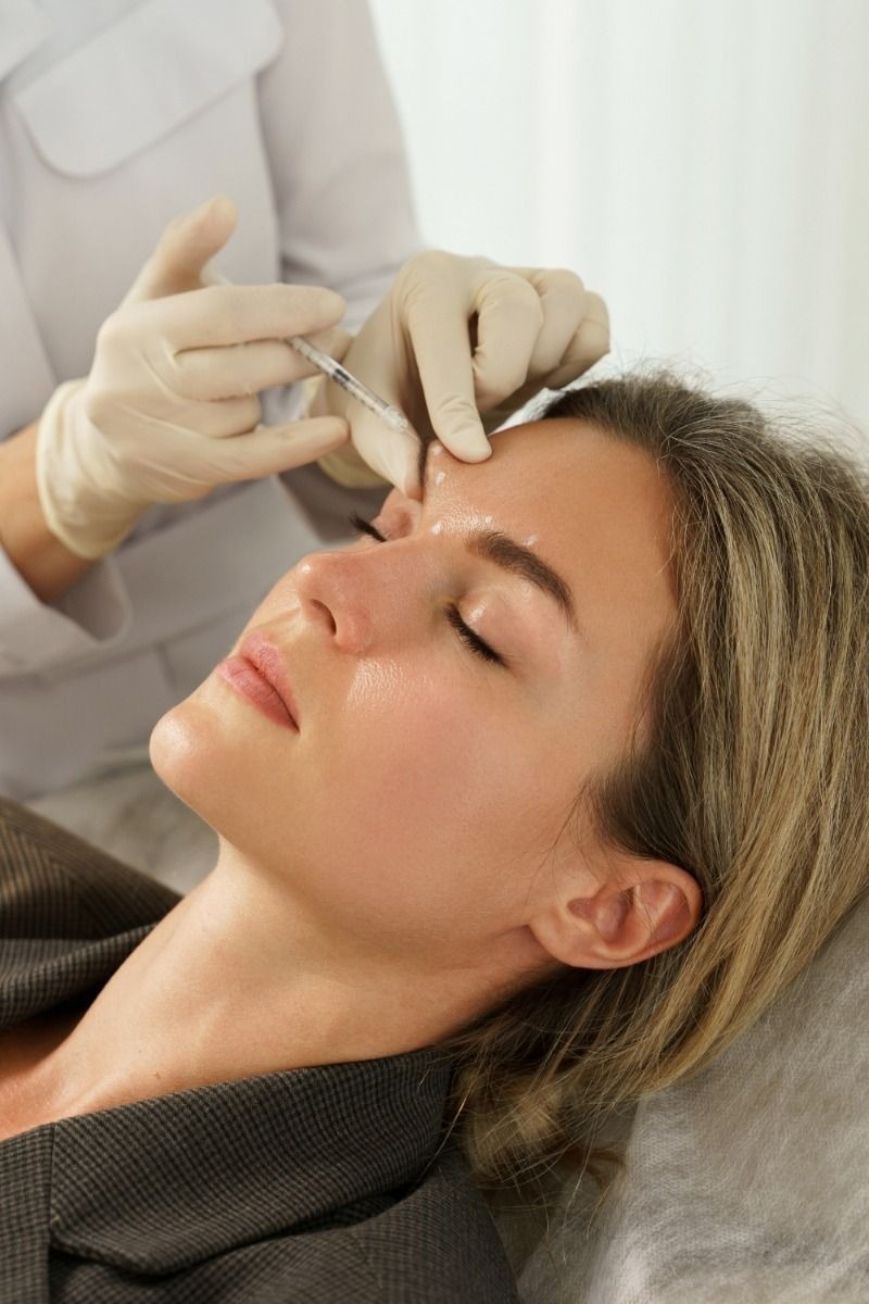 Caso clínico — Botox & Preenchimento Labial